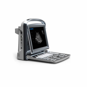 Ecógrafo ECO1 Chison