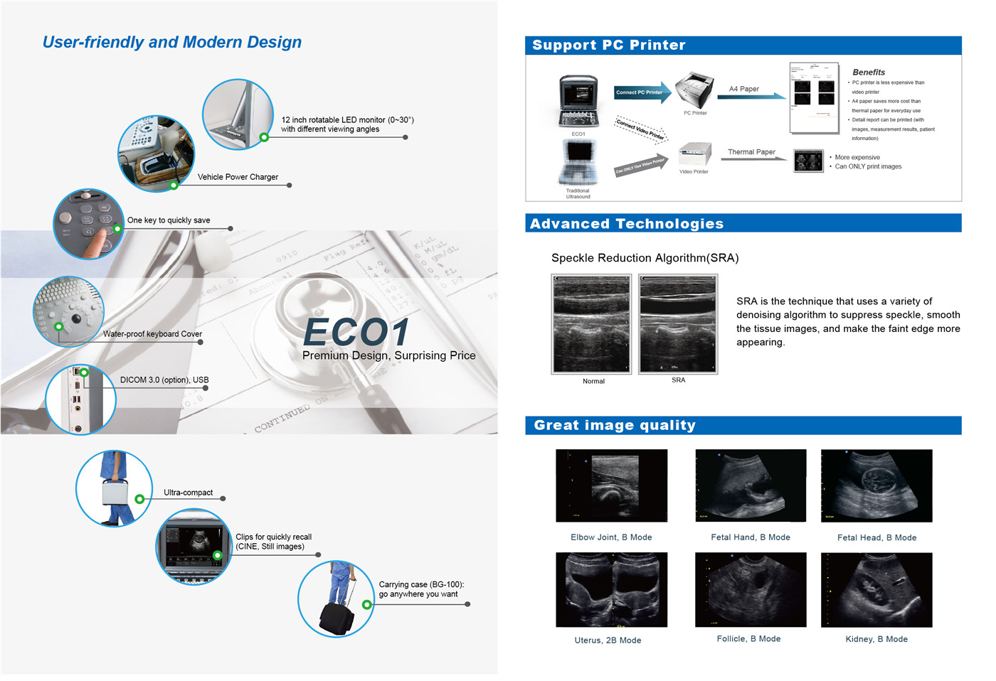 Chison ECO1