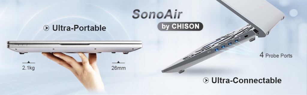 SonoAir Chison